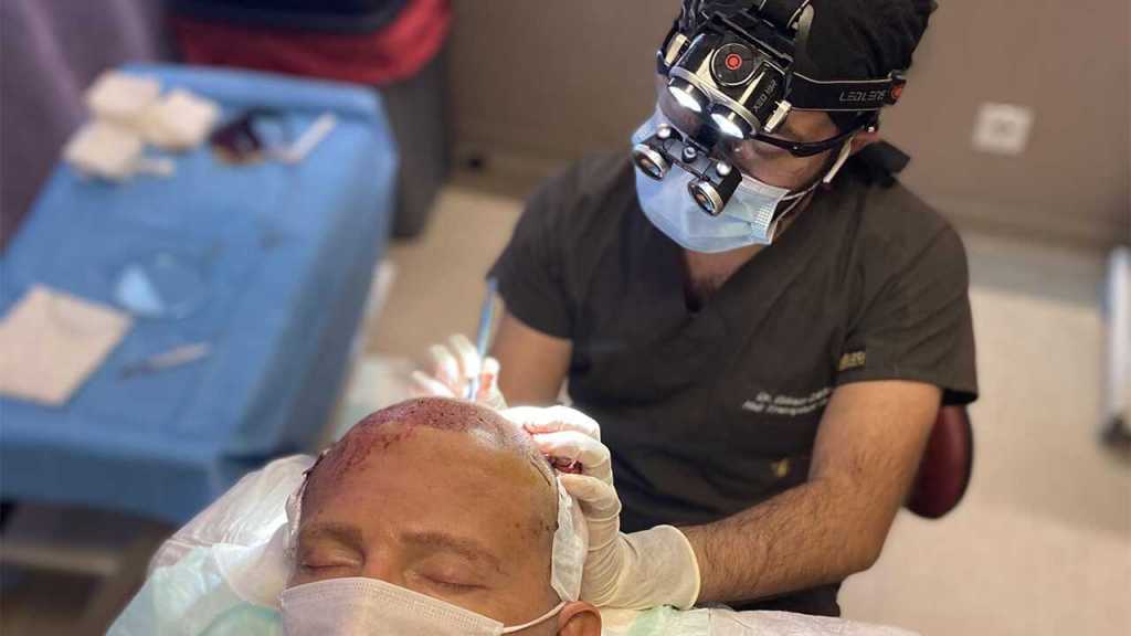 Meet Dr. Erkam — Owner & Lead Surgeon 1 dr-caymaz-best-hair-transplant-surgeon-1