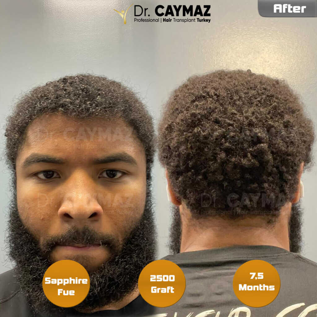 7,5-months-later-afro 7,5-months-later-afro