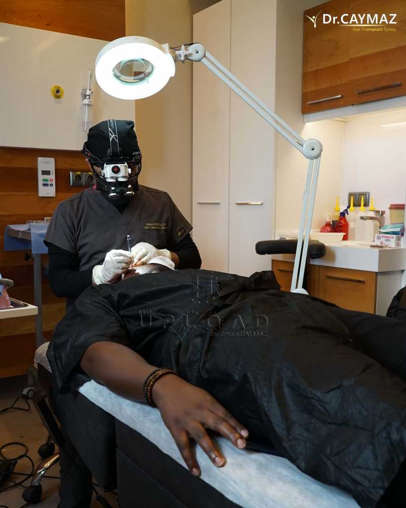 beard-transplantation (3)