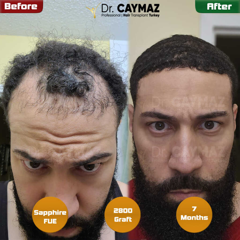 chris-7-months-result-9 chris-7-months-result-9