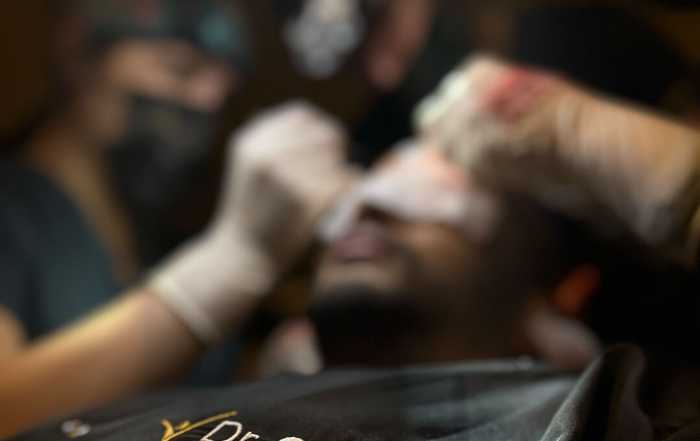 Hair Upload - Hair Transplant Turkey – Istanbul - 2026 12 dr-caymaz-hair-234