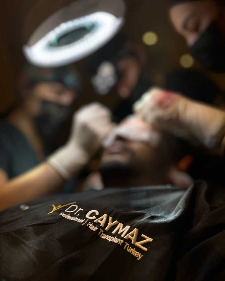 Second Hair Transplant: When Your Donor Reserve Still Allows a Touch-Up 4 dr-caymaz-hair-234
