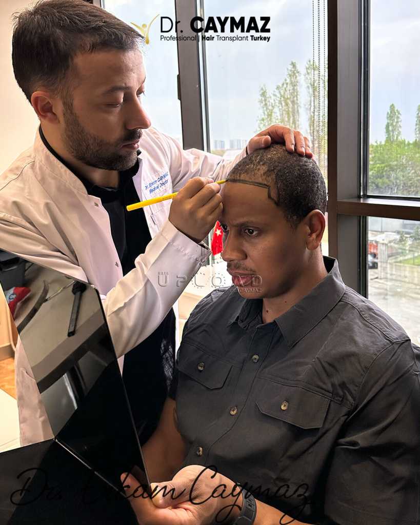 dr-caymaz-hairline