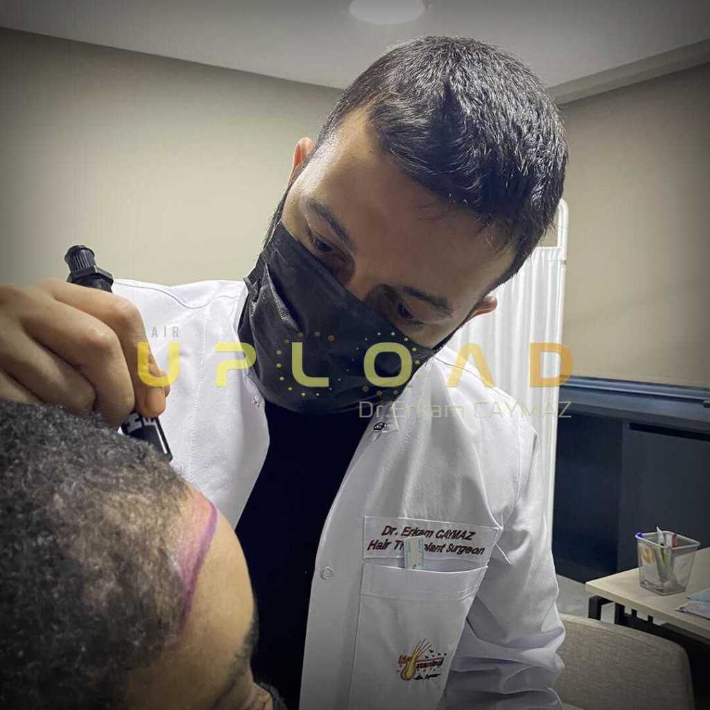 hair-line-design-dr-caymaz-afro-american-woman afro women hair line draw