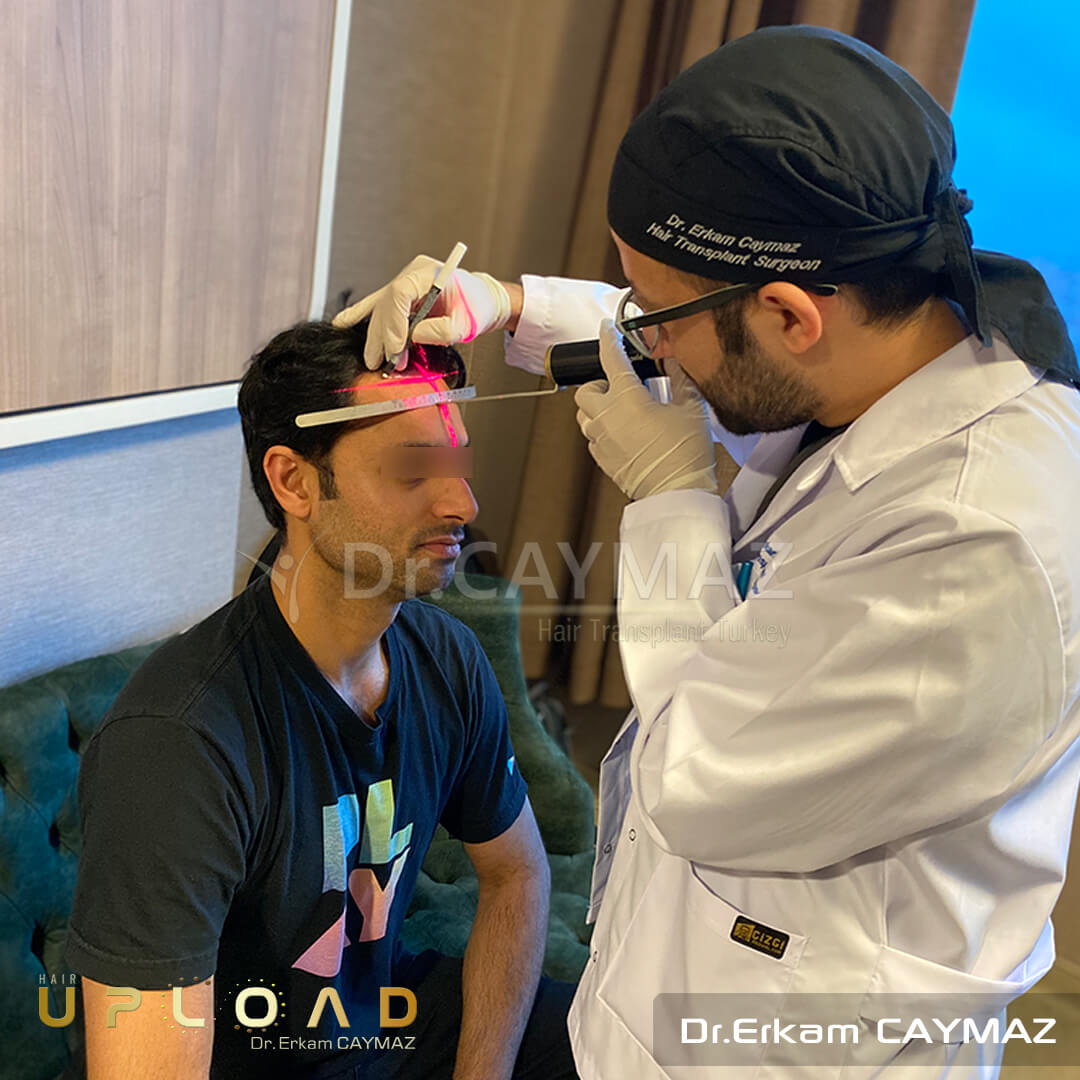 Hair Transplant Process 3 hair transplant process