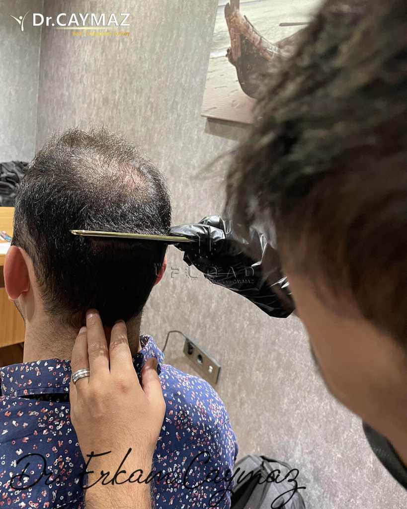 hairline-desing