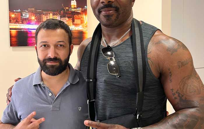 Hair Upload - Hair Transplant Turkey – Istanbul - 2026 13 happy-patients-from-all-around-the-world