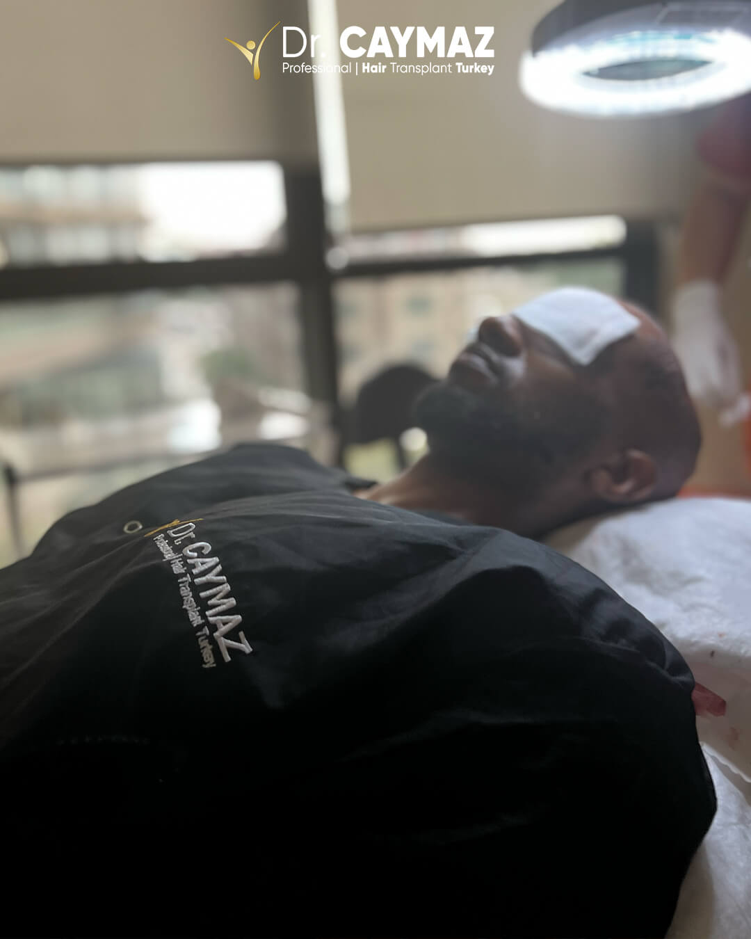 Hair Transplant Success Rate? 6 implanted-dr-caymaz