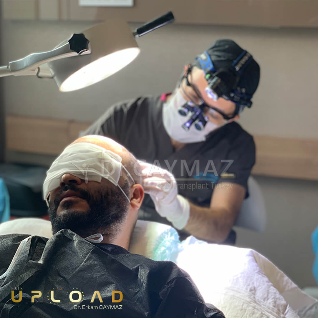 Hair Transplant Turkey 4 dr-erkam-caymaz-hair-transplant-turkey