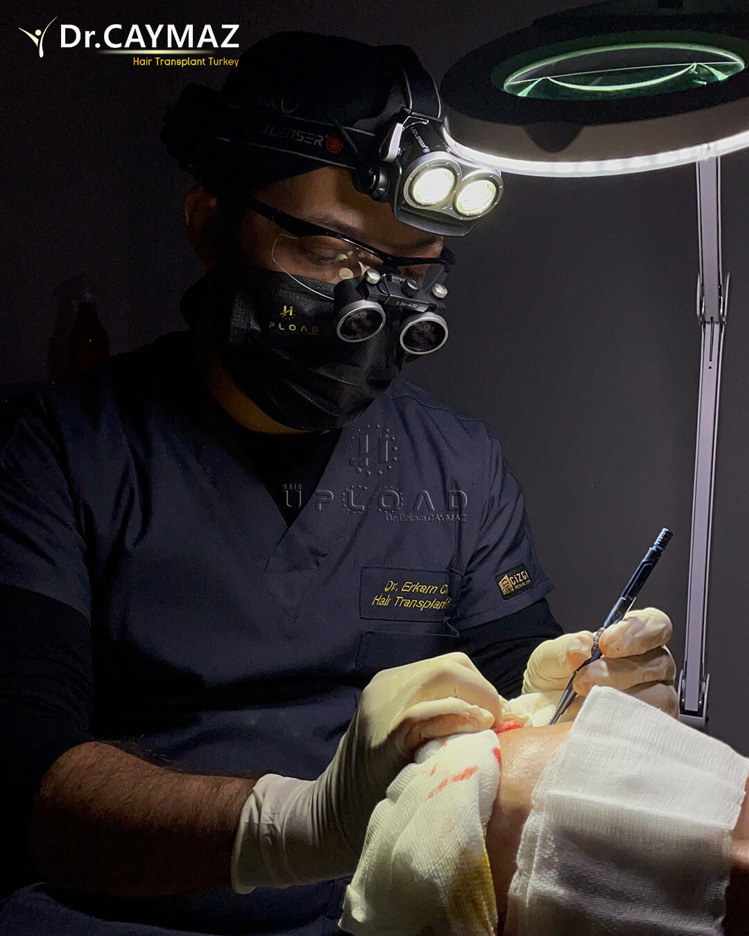Finasteride and Hair Transplant: Optimising Results and Safety 4 sapphire fue dr caymaz 786